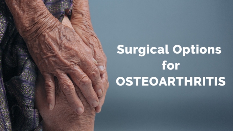 Surgical Treatment Options of Osteoarthritis