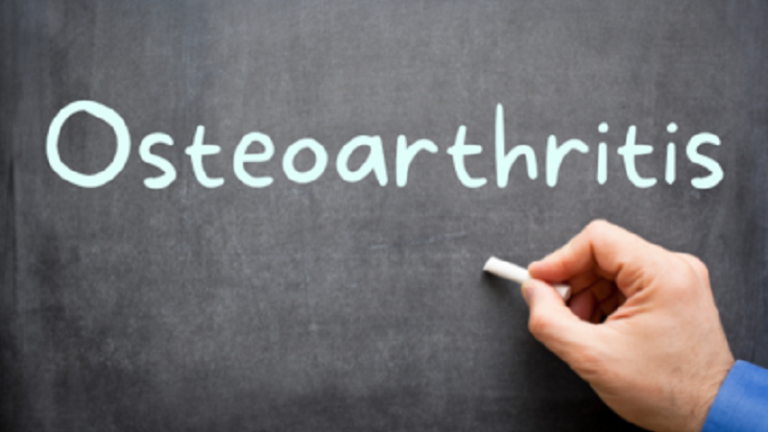 Patient Education Series : Osteoarthritis