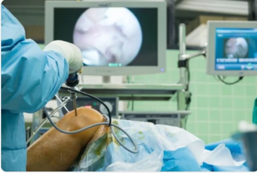 Understanding Anterior Cruciate Ligament (ACL) Surgery